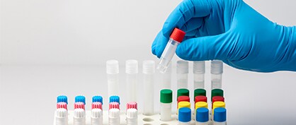 Vier Tipps zur Verhinderung von Kreuzkontaminationen im Labor