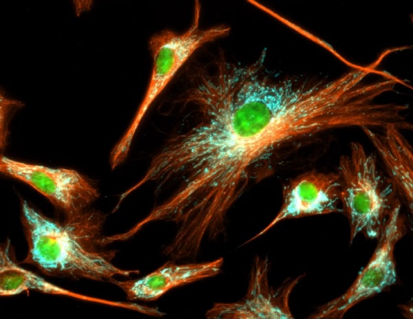 Immunfluoreszenzanalyse von Tubulin in BPAE-Zellen mit Überlagerungen von Mitochondrien (ATP-Synthase, cyan), Tubulin (orange) und Kernen (grün)