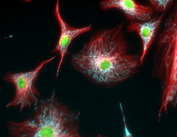 Immunfluoreszenzanalyse von Tubulin in BPAE-Zellen mit Überlagerungen von Mitochondrien (ATP-Synthase, cyan), Tubulin (rot) und Kernen (grün)