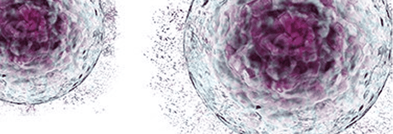 Herausforderungen an die Ausrüstung bei der Maßstabsübertragung von Zelltherapieprozessen