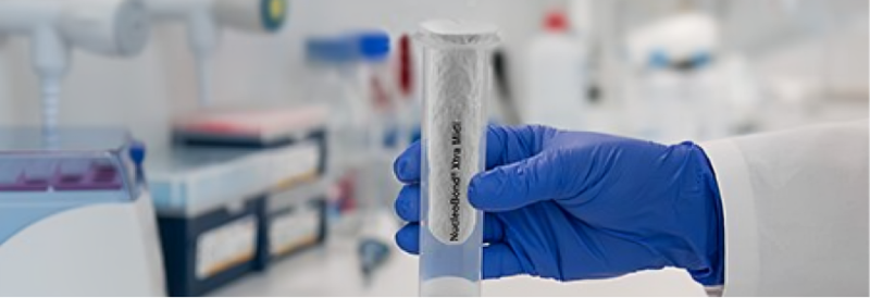 Herausforderungen bei der Verwendung von Plasmid-DNA für Biopharma und Gentherapie