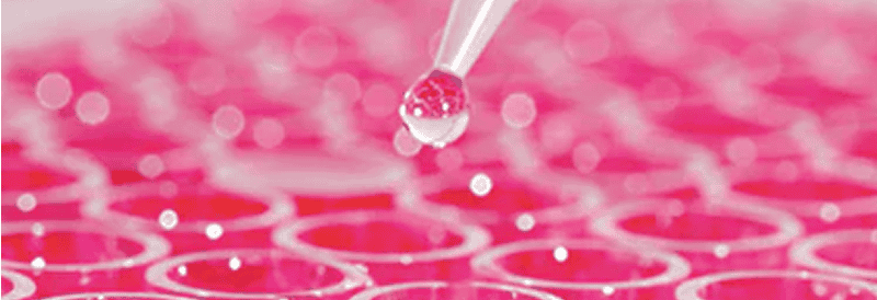 Massenproduktion von Lentivirus-Vektoren durch transiente Transfektion