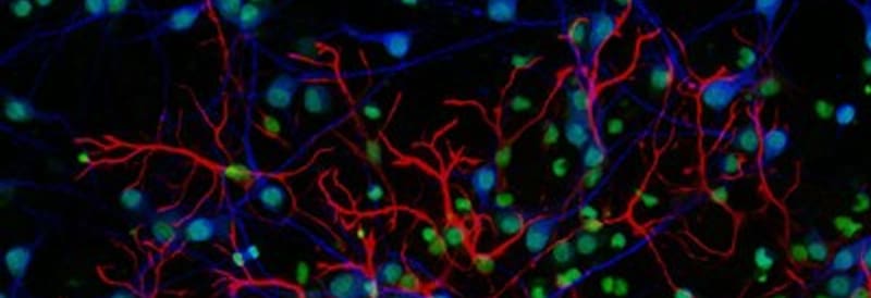 Technologische Fortschritte in der Fluoreszenzmikroskopie