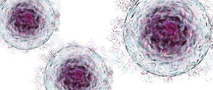 Equipment Challenges in Scaling Up Cell Therapy Processes Equipment Challenges in Scaling Up Cell Therapy Processes